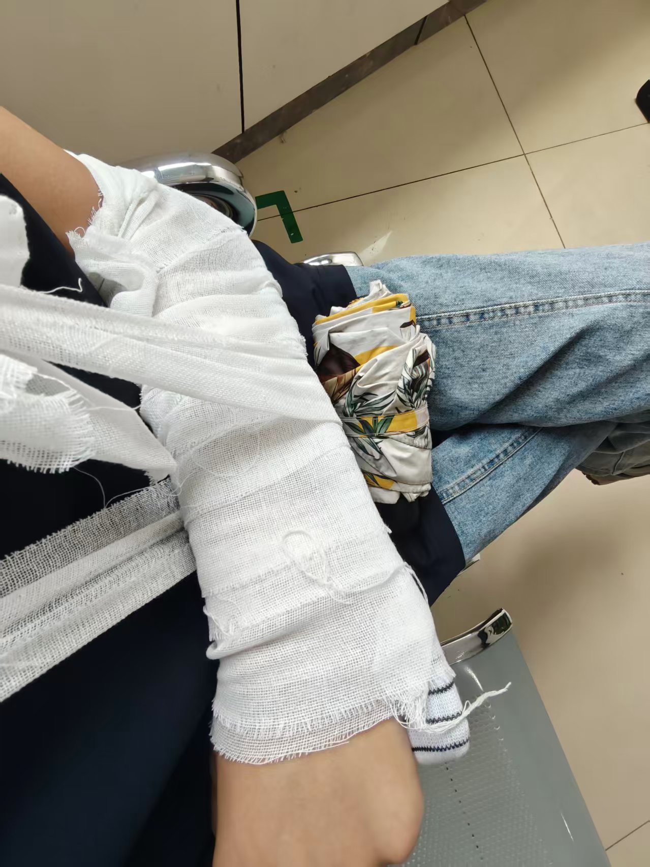 left_elbow