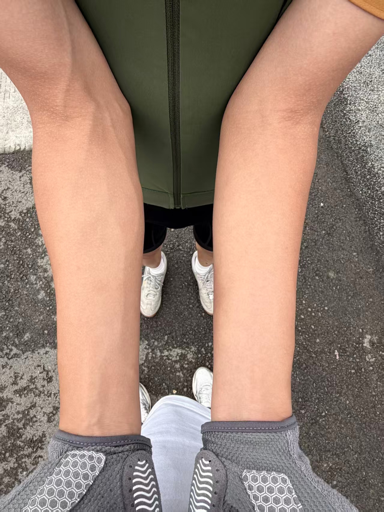 arm